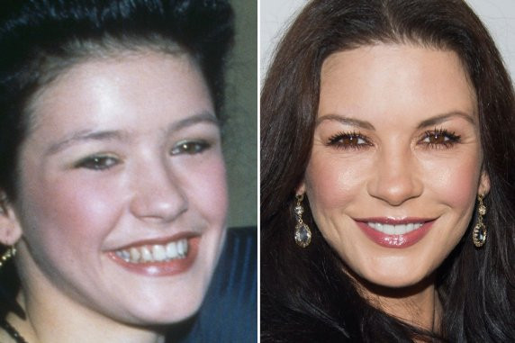 Nữ hoàng điện ảnh Catherine Zeta Jones vẫn giấu một bí mật trước khi cô nổi tiếng là hàm răng khá “thô”. Năm 2009, Catherine tiết lộ việc cô giữ gìn răng bằng cách thường xuyên ăn một quả táo để đánh bóng cho răng sau khi đã “tân trang” lại với răng sứ.