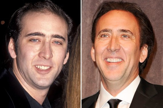 Nam tài tử từng đoạt giải Osca Nicholas Cage từng bị một người sưu tầm tung tấm hình những ngày đầu của anh với dòng ghi chú “Nic Cage là một ma cà rồng”, đơn giản vì hàm răng của anh “có vấn đề”, mặc dù giờ đây không ai còn nhìn thấy Cage với hàm răng ma cà rồng như trước nữa.