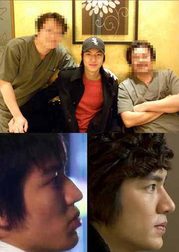 Mũi thẳng do thẩm mỹ mà có Khám phá khuôn mặt thật của sao Hàn