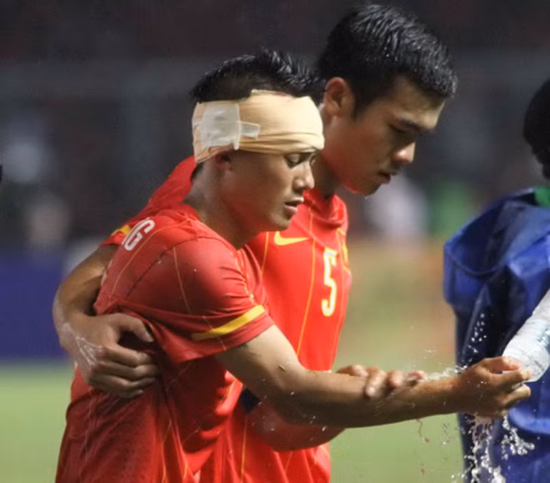 Vệt sáng duy nhất trong đường hầm mà U23 Việt Nam đã đi qua, đó là chiếc băng đầu của Thành Lương