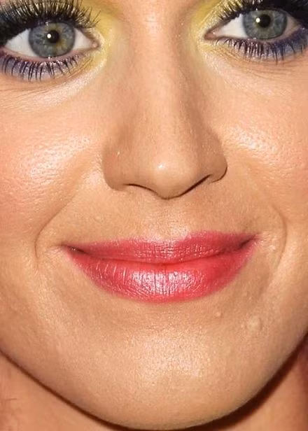 Katy Perry với làn da sần sùi.