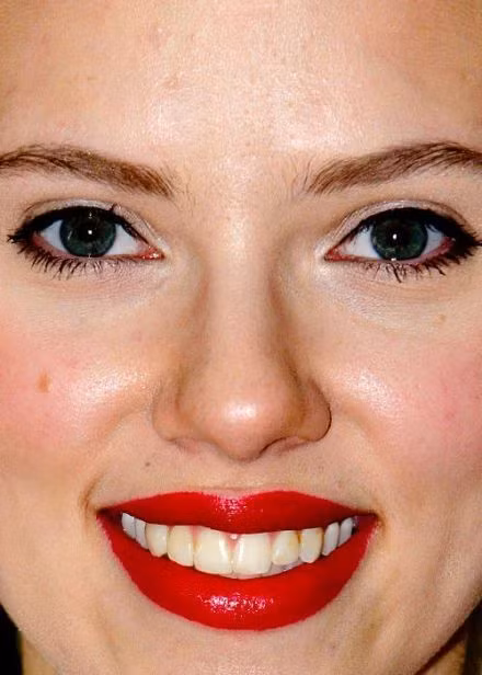Bức ảnh chụp cận mặt cho thấy làn da nổi mụn và "răng vàng" của Scarlett Johansson.