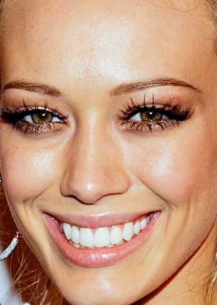Jessica Marie Alba với da mặt khá nhiều mụn.
