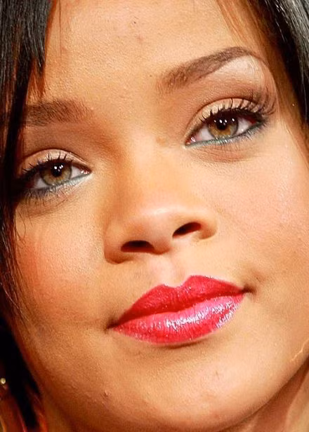Rihanna khiến mọi người phải thất vọng về dàn da quá thô và mụn của mình.