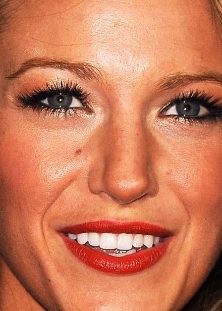 Da mặt của Blake Lively không những đen sạm, lỗ chân lông lớn mà cũng rất nhiều tàn nhang.