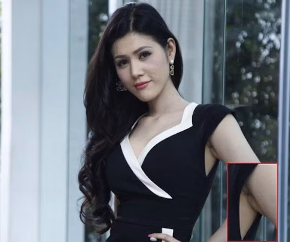 'Siêu vòng 1' Maria Đinh Phương Ánh là người mới đây nhất lộ vết tích dao kéo vòng 1 của mình 'Siêu vòng 1' Maria Đinh Phương Ánh là người mới đây nhất lộ vết tích dao kéo vòng 1 của mình