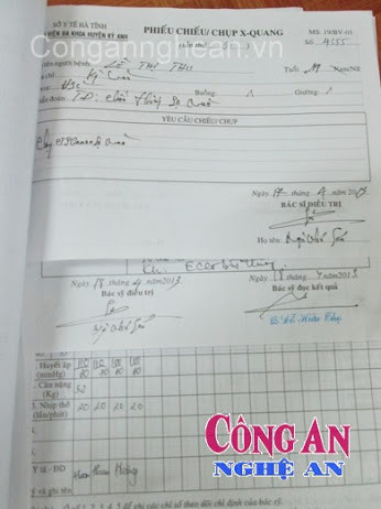 Chẩn đoán nạn nhân bị chấn thương sọ não của BVĐK Kỳ Anh. Ảnh: Công an Nghệ An Chẩn đoán nạn nhân bị chấn thương sọ não của BVĐK Kỳ Anh. Ảnh: Công an Nghệ An