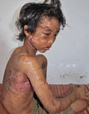 "Cậu bé bạo hành Hào Anh" bị bắt vì trộm máy tính ảnh 2 "Cậu bé bạo hành Hào Anh" bị bắt vì trộm máy tính ảnh 2