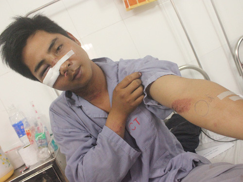 Anh Nghiêm Duy Hoàng đang điều trị tại bệnh viện với nhiều vết thương trên người