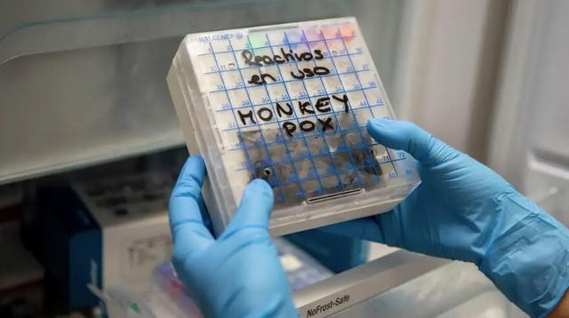 Ảnh minh họa: nguồn Cổng thông tin điện tử Bộ Y tế Ảnh minh họa: nguồn Cổng thông tin điện tử Bộ Y tế