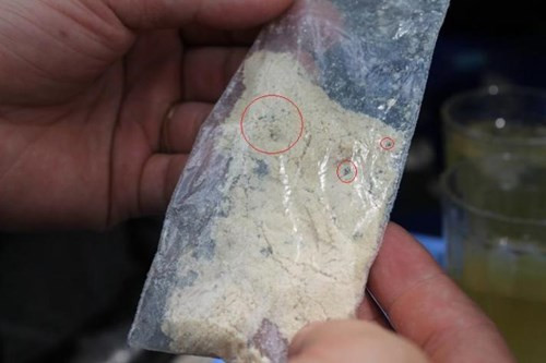 Vật thể lạ là những cục nhỏ mầu đen, cứng (vòng tròn đỏ)