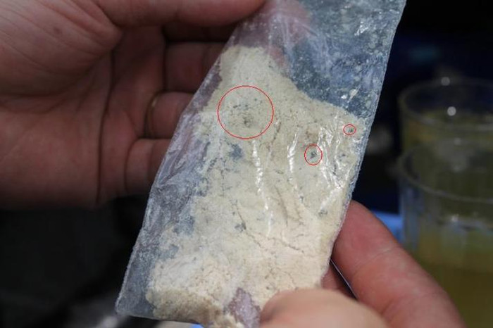 Vật thể lạ là những cục nhỏ mầu đen, cứng (vòng tròn đỏ)