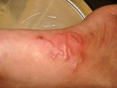 Mu mat, say thai vi nuoi thu cung