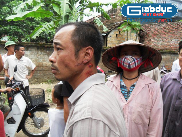 Mặc dù cũng bị hung thủ chém trọng thương nhưng với anh Khuất Xuân Phương - bác ruột nạn nhân, vết thương trong lòng mới là nỗi đau lớn hơn hết.