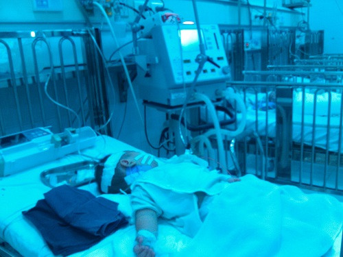 Trẻ nhỏ là đối tượng hay mắc bệnh viêm não Nhật Bản nhất. Ảnh: Một bệnh nhi mắc Viêm não Nhật Bản đang điều trị tại khoa Truyền nhiễm - BV Nhi Trung ương/ảnh LP.