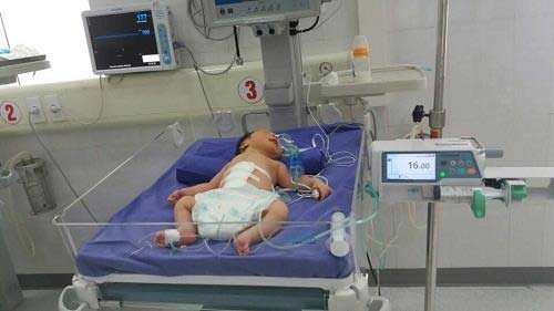 Bé Vũ Đặng Thùy Vân sau khi phẫu thuật. Ảnh: LP. Bé Vũ Đặng Thùy Vân sau khi phẫu thuật. Ảnh: LP.