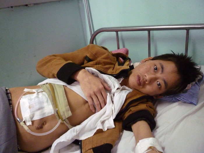 Biết mình sẽ là học sinh lớn tuổi nhất của lớp học trong bệnh viện, Nguyễn Đình Tuấn, 18 tuổi, điều trị suy thận ở Khoa Nội thận tiết niệu A11 vẫn muốn tham gia lớp học. (Ảnh Thu Hòe)