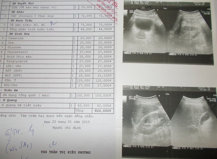 Siêu âm bụng tổng quát (màu) có giá 150.000 đồng, ảnh giao cho bệnh nhân là đen trắng (Ảnh: Xuân Dương) Siêu âm bụng tổng quát (màu) có giá 150.000 đồng, ảnh giao cho bệnh nhân là đen trắng (Ảnh: Xuân Dương)