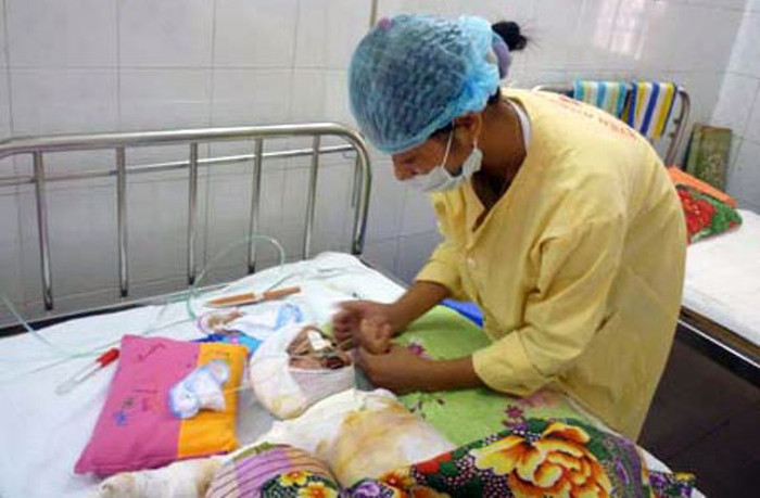 100% các ca trẻ nhập viện điều trị bỏng ở Khoa bỏng nhi, Viện Bỏng Quốc Gia là do người lớn lơ là, mất cảnh giác (Ảnh Thu Hòe).