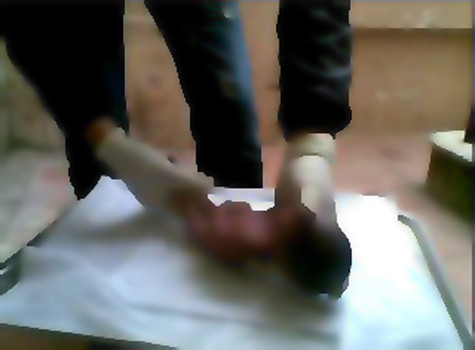 Sau khi tắm rửa sạch sẽ cho xác thai nhi, C. đang đặt xác em nhỏ lên tấm khăn trắng, chuẩn bị cho việc mai táng một cách tươm tất. Sau khi tắm rửa sạch sẽ cho xác thai nhi, C. đang đặt xác em nhỏ lên tấm khăn trắng, chuẩn bị cho việc mai táng một cách tươm tất.