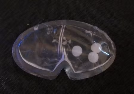 Không phải silicone, "chất lạ" trong áo ngực này là gì đang được dư luận và đặc biệt là chị em phụ nữ quan tâm. (Ảnh: vietnamnet)