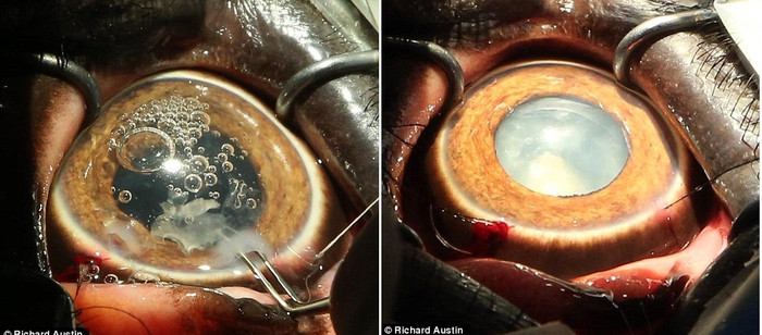 Các bác sĩ nhãn khoa thú y đang tiến hành lấy phần thủy tinh thể bị hỏng ra khổ mắt Duchess Các bác sĩ nhãn khoa thú y đang tiến hành lấy phần thủy tinh thể bị hỏng ra khổ mắt Duchess