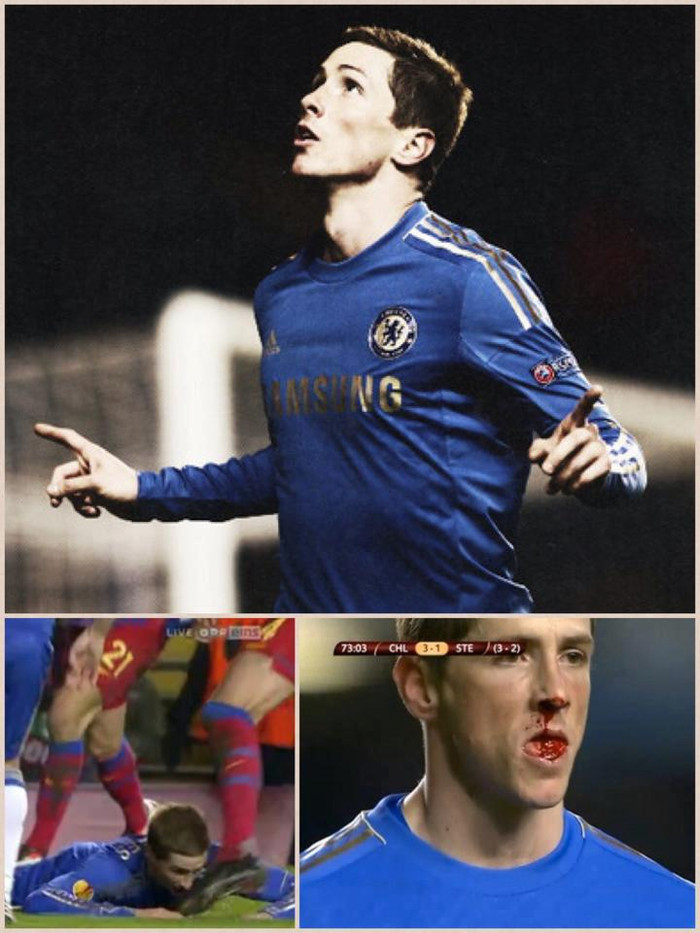 2 phút sau, Ramires tiếp tục có đường chuyền dọn cỗ cho Torres nhưng trung vệ của đội khách đã kịp thời truy cản... Ở tình huống va chạm sau đó, giày của cầu thủ đội khách đã va chạm vào mặt của El Nino khiến anh đổ máu mũi... 2 phút sau, Ramires tiếp tục có đường chuyền dọn cỗ cho Torres nhưng trung vệ của đội khách đã kịp thời truy cản... Ở tình huống va chạm sau đó, giày của cầu thủ đội khách đã va chạm vào mặt của El Nino khiến anh đổ máu mũi...