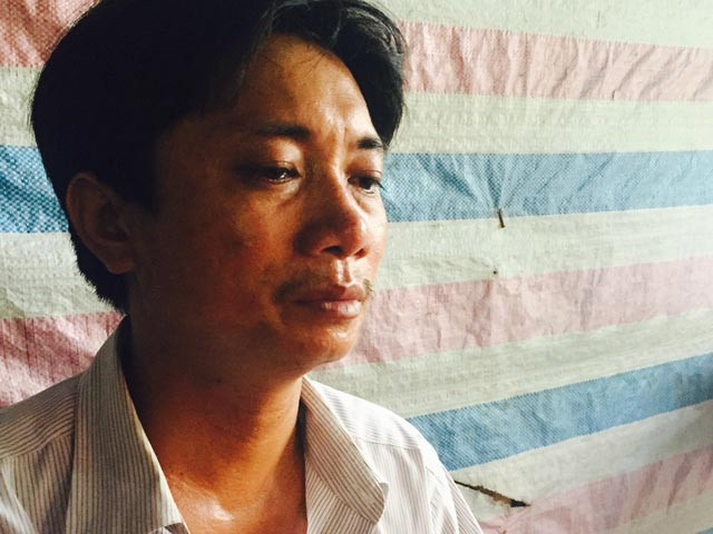 Anh Tư đau đớn kể lại vụ việc (Ảnh: Trúc Linh)