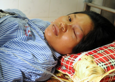 Chị Thủy bên giường bệnh. Ảnh: Thái Thịnh. Chị Thủy bên giường bệnh cho biết mắt vẫn còn khá nhức, nước mắt thường xuyên chảy ra. Ảnh: Thái Thịnh.