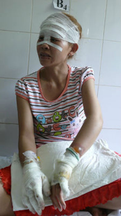 Nạn nhân thuật lại câu chuyện Nạn nhân thuật lại câu chuyện