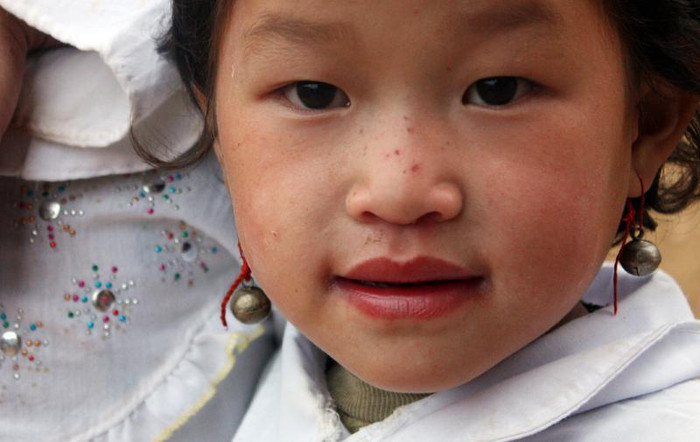 Mũi đỏ ửng vì không có áo ấm, khăn, mũ để đội. Mũi đỏ ửng vì không có áo ấm, khăn, mũ để đội.