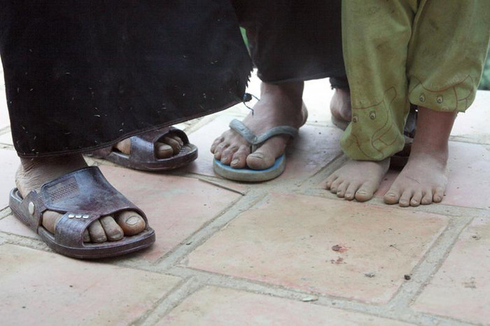 Nhìn những đôi chân trần mà thấy xót xa Nhìn những đôi chân trần mà thấy xót xa