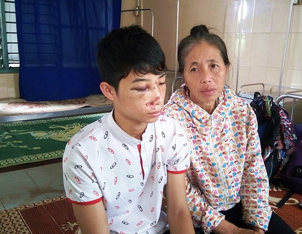 Trưởng Công an xã phủ nhận việc đánh học sinh lớp 10 nhưng có đến ... xin lỗi ảnh 1 Trưởng Công an xã phủ nhận việc đánh học sinh lớp 10 nhưng có đến ... xin lỗi ảnh 1