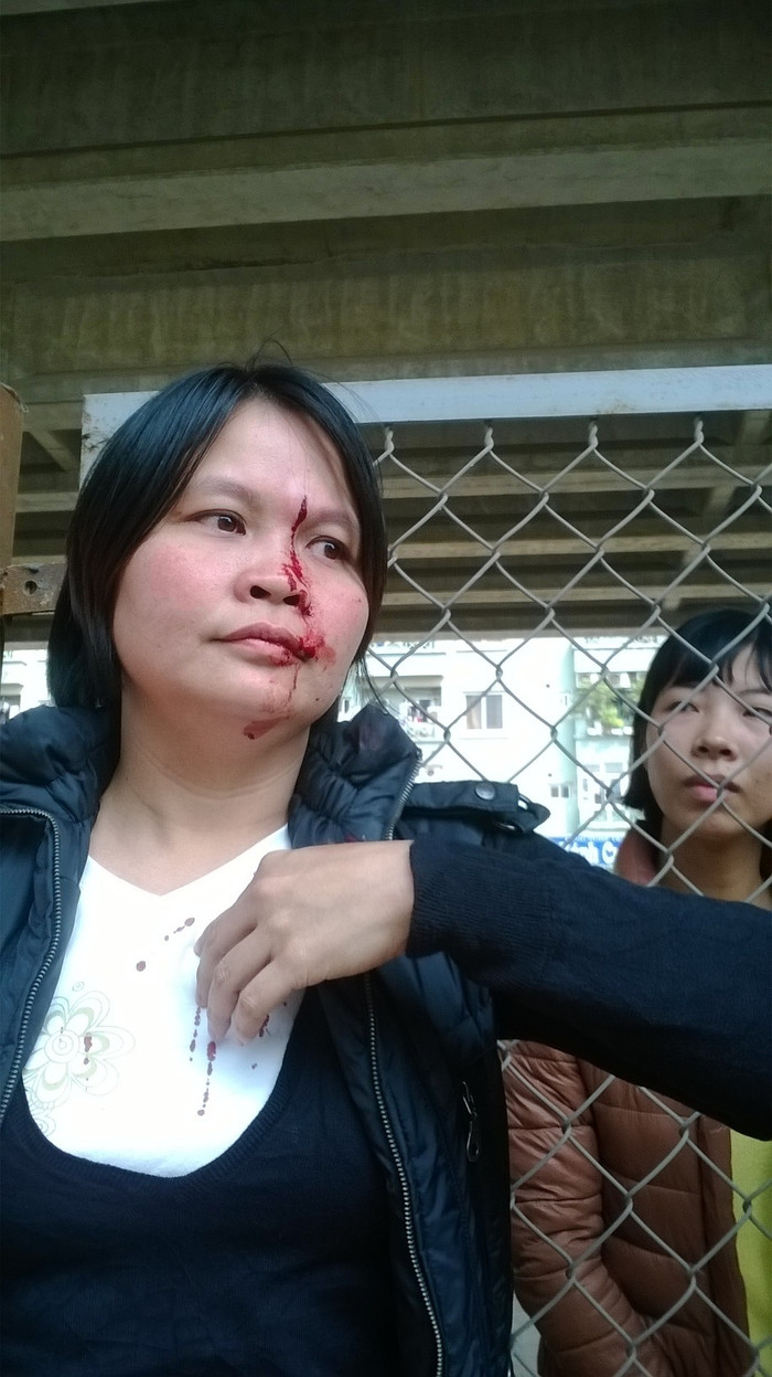 Bị đánh chảy máu rất đau đớn nhưng người phụ nữ này vẫn không thôi ý định yêu cầu được gặp chủ đầu tư.