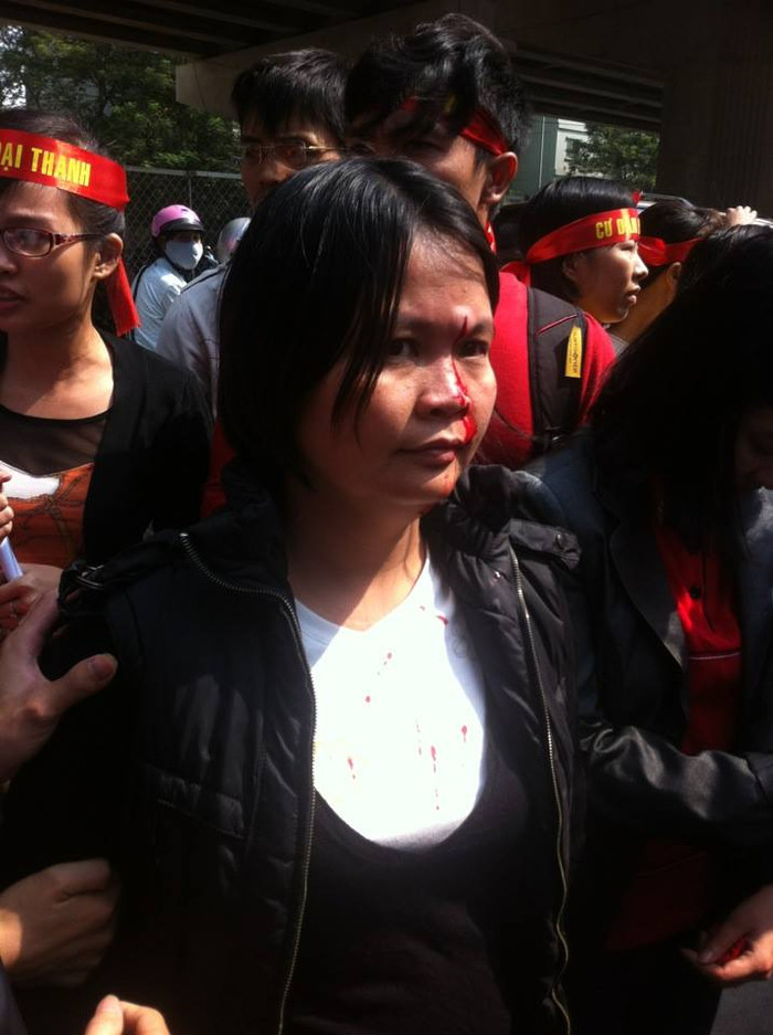 Một phụ nữ bị bảo vệ, được cho là người của Đại Thanh đánh chảy máu đầy mặt.