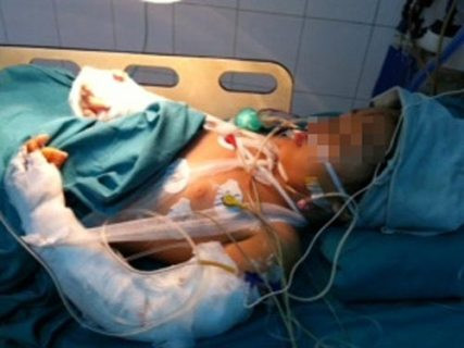 Sau 1 tuần được điều trị tích cực, cháu Bích đã có thể chuẩn bị ra viện (Ảnh: NLD Online) Sau 1 tuần được điều trị tích cực, cháu Bích đã có thể chuẩn bị ra viện (Ảnh: NLD Online)