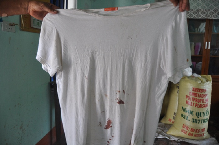 Chiếc áo bị đâm sượt qua bụng trúng tay trái khiến ông Nam phải khâu 6 mũi. Chiếc áo bị đâm sượt qua bụng trúng tay trái khiến ông Nam phải khâu 6 mũi.