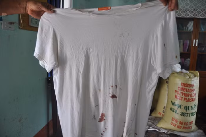 Chiếc áo bị đâm sượt qua bụng trúng tay trái khiến ông Nam phải khâu 6 mũi.