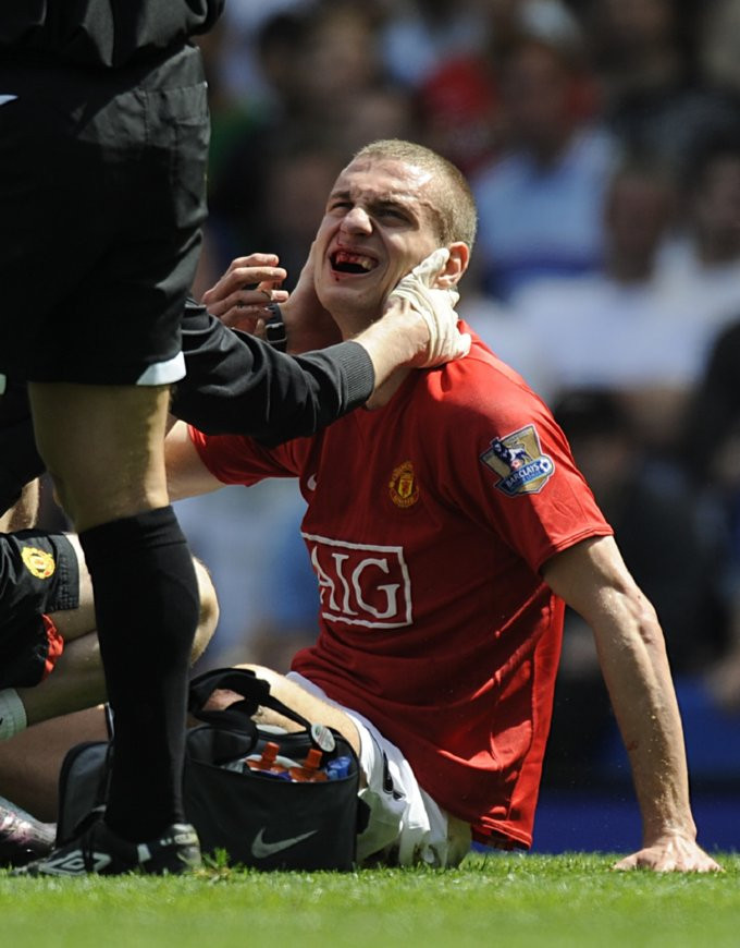 Trung vệ Nemanja Vidic khá đau sau một pha va chạm với Didier Drogba. Trung vệ Nemanja Vidic khá đau sau một pha va chạm với Didier Drogba.