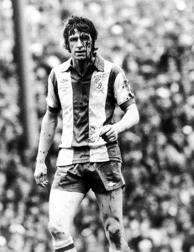 Cựu cầu thủ của West Brom, John với vết thương khá nặng ở trán. Cựu cầu thủ của West Brom, John với vết thương khá nặng ở trán.