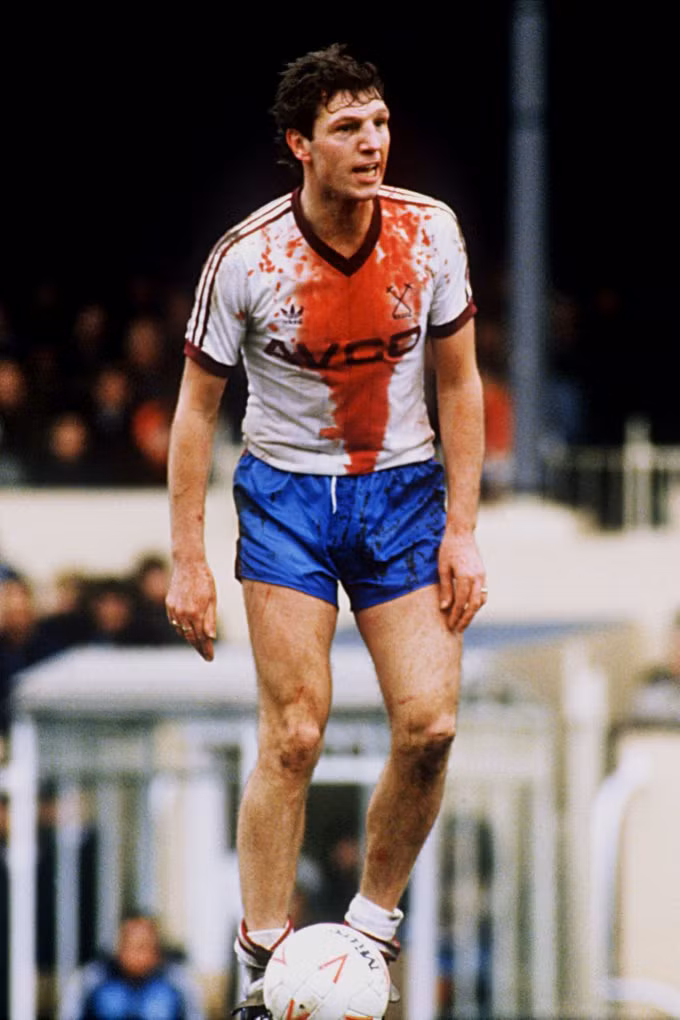 Cựu hậu vệ Alvin Martin của CLB West Ham năm 1985.