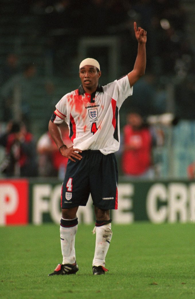 Cựu tiền vệ tuyển Anh, Paul Ince bị chấn thương nặng khi thi đấu ở VCK World Cup 1998. Cựu tiền vệ tuyển Anh, Paul Ince bị chấn thương nặng khi thi đấu ở VCK World Cup 1998.
