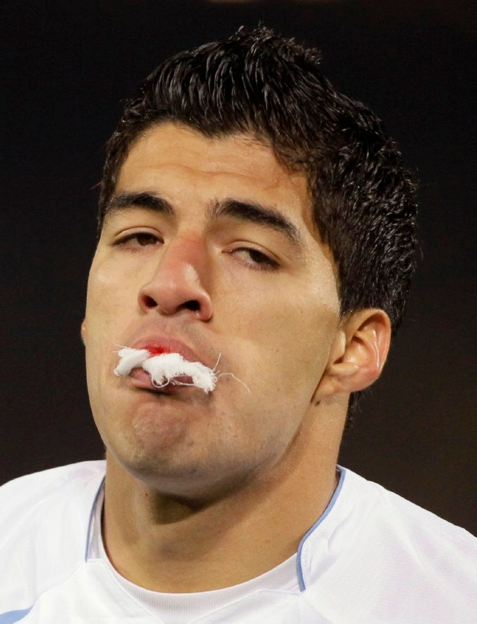 Luis Suarez cũng từng gặp phải những chấn thương nặng. Luis Suarez cũng từng gặp phải những chấn thương nặng.