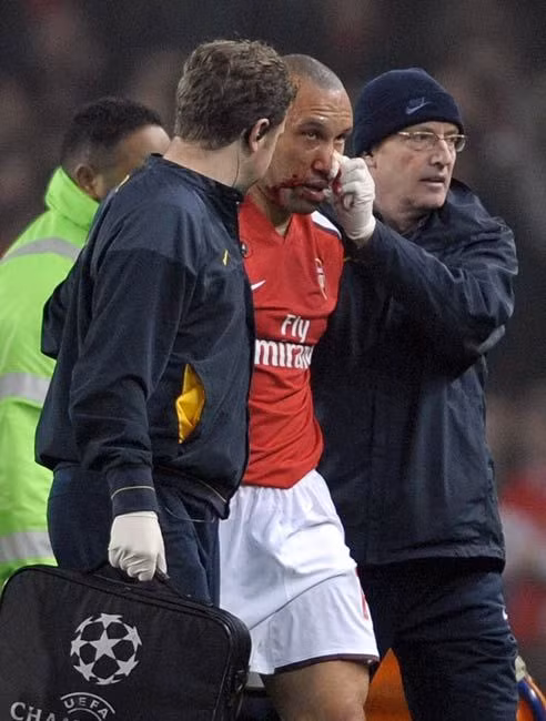 Khi mới chuyển tới Arsenal từ MU năm 2008 thì lão tướng Silvestre đã nhanh chóng tạo dấu ấn với pha chấn thương mũi mất rất nhiều máu trong trận Arsenal hoà không bàn thắng trước Fenerbahce trong khuôn khổ Champions League.