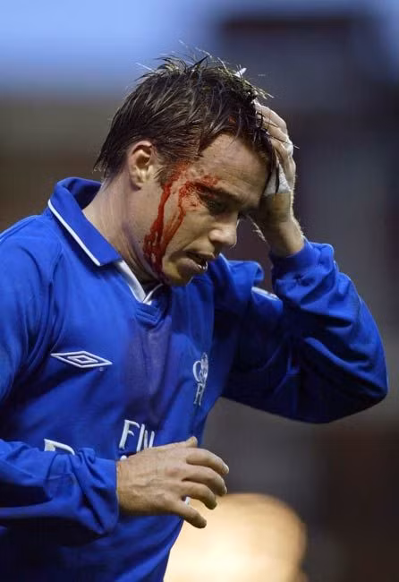 Hẳn không ít CĐV của sân Stamford Bridge vẫn còn nhớ cựu tuyển thủ Anh và Chelsea đã giải nghệ, Le Saux. Anh không chỉ ghi nhiều bàn thắng mà còn chơi rất năng nổ, thế nên việc dính chấn thương là hoàn toàn dễ hiểu. Chỉ tiếc trong trận đấu này, Chelsea để thua 2-3 trước Arsenal và những nỗ lực lăn xả của anh trở thành phí công vô ích.