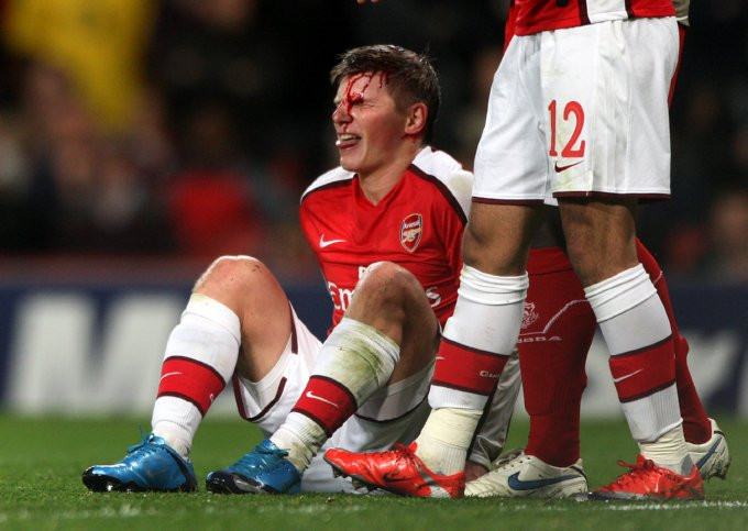 Andrey Arshavin đau đớn sau pha va chạm với chính người đồng đội William Gallas. Andrey Arshavin đau đớn sau pha va chạm với chính người đồng đội William Gallas.