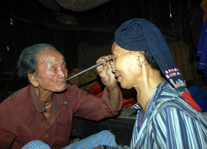 Đến nhà thầy, Tôi phải tự tay mổ, luộc gà, xếp đũa bát, bỏ thêm chai rượu làm mâm đồ cúng. Ông lấy hương đốt huơ quanh người tôi rồi vén áo lên, lấy ống hút dí vào sườn trái. Trước khi hút bệnh, ông uống một chén nước cho mồm miệng sạch, lau ống hút, lấy cả lông gà không cho bất kỳ một dị vật nào ở trong. Lúc hút tôi có cảm giác như bị ai véo vào da thịt, giật một cái, sau đó nhẹ nhõm, mát người lắm! Ông hút ra được một viên đá bằng hạt đỗ, màu trắng, bỏ vào cái bát rồi nhổ một bãi nước bọt. Hòn đá ấy lại được bỏ vào bếp than đang rực lửa. Kỳ lạ là đã ba năm nay tôi không bị đau lưng và đau đại tràng nữa”. Ông Bùi Ngọc Thích, Chủ tịch Mặt trận Tổ quốc xã Đồng Nghê (Đà Bắc, Hòa Bình), vốn bị thoái hóa 1 đốt sống lưng, đau đại tràng mãn tính kể lại. Đến nhà thầy, Tôi phải tự tay mổ, luộc gà, xếp đũa bát, bỏ thêm chai rượu làm mâm đồ cúng. Ông lấy hương đốt huơ quanh người tôi rồi vén áo lên, lấy ống hút dí vào sườn trái. Trước khi hút bệnh, ông uống một chén nước cho mồm miệng sạch, lau ống hút, lấy cả lông gà không cho bất kỳ một dị vật nào ở trong. Lúc hút tôi có cảm giác như bị ai véo vào da thịt, giật một cái, sau đó nhẹ nhõm, mát người lắm! Ông hút ra được một viên đá bằng hạt đỗ, màu trắng, bỏ vào cái bát rồi nhổ một bãi nước bọt. Hòn đá ấy lại được bỏ vào bếp than đang rực lửa. Kỳ lạ là đã ba năm nay tôi không bị đau lưng và đau đại tràng nữa”. Ông Bùi Ngọc Thích, Chủ tịch Mặt trận Tổ quốc xã Đồng Nghê (Đà Bắc, Hòa Bình), vốn bị thoái hóa 1 đốt sống lưng, đau đại tràng mãn tính kể lại.