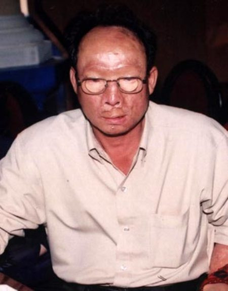 Lê Ngọc Lâm, tự Lâm "chín ngón" là giang hồ cộm cán tại miền Nam trước năm 1975. Ngày 14/7/1999, ông Lâm chở vợ và con trai 6 tuổi đi ăn tối trên đường Sư Vạn Hạnh nối dài (quận 10, TP HCM). Anh ta vừa dừng xe cho vợ con bước xuống thì bất ngờ một thanh niên nhảy xổ tới, tạt thẳng một ca axít vào mặt Lâm. Hét lên một tiếng, Lâm ngã xuống mặt đường quằn quại. Sự việc xảy ra lúc 20h ngày 14/7/1999 làm Lâm cháy toàn bộ khuôn mặt, hai tai; mũi rụng, cằm chảy ra dính chặt vào ngực. Lê Ngọc Lâm, tự Lâm "chín ngón" là giang hồ cộm cán tại miền Nam trước năm 1975. Ngày 14/7/1999, ông Lâm chở vợ và con trai 6 tuổi đi ăn tối trên đường Sư Vạn Hạnh nối dài (quận 10, TP HCM). Anh ta vừa dừng xe cho vợ con bước xuống thì bất ngờ một thanh niên nhảy xổ tới, tạt thẳng một ca axít vào mặt Lâm. Hét lên một tiếng, Lâm ngã xuống mặt đường quằn quại. Sự việc xảy ra lúc 20h ngày 14/7/1999 làm Lâm cháy toàn bộ khuôn mặt, hai tai; mũi rụng, cằm chảy ra dính chặt vào ngực.