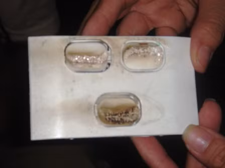 Bé gái \'gây cháy\' ở TP.HCM giờ ra sao?