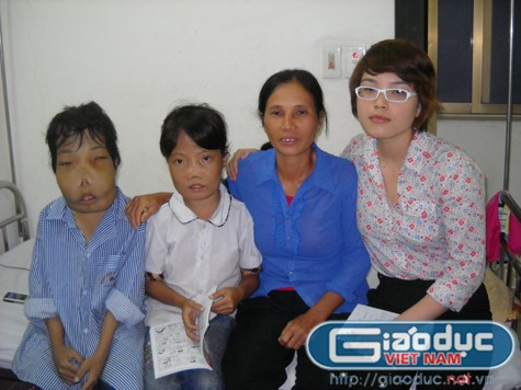 Nụ cười hiếm hoi trên khuôn mặt chị Tâm trước những đau thương của số phận Nụ cười hiếm hoi trên khuôn mặt chị Tâm trước những đau thương của số phận